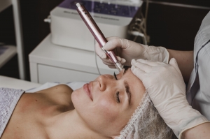 Is Jet Peel Skin Treatment Right for You? A Comprehensive Guide